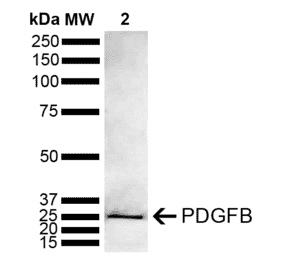 Western Blot - Anti-PDGF B Antibody (A305184) - Antibodies.com