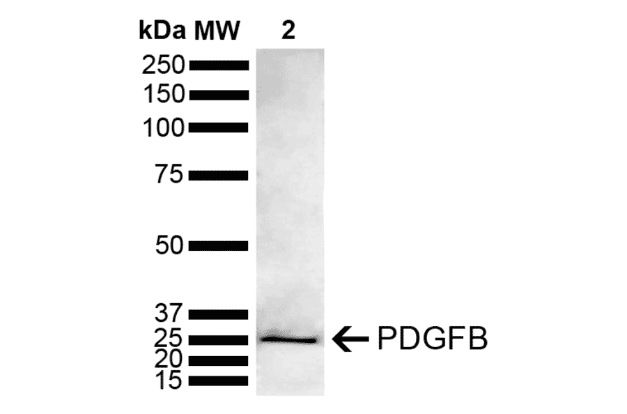 Western Blot - Anti-PDGF B Antibody (A305184) - Antibodies.com
