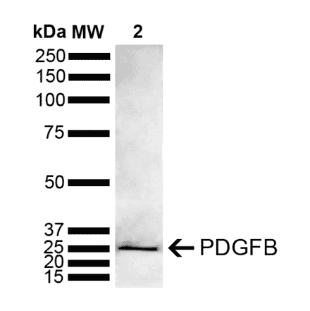 Western Blot - Anti-PDGF B Antibody (A305184) - Antibodies.com