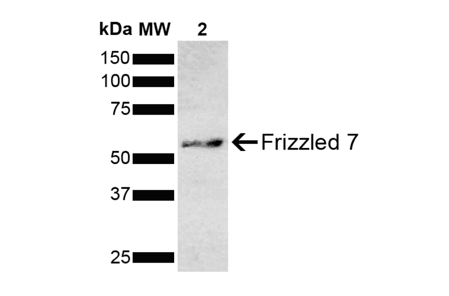 Western Blot - Anti-Frizzled 7 Antibody (A305186) - Antibodies.com