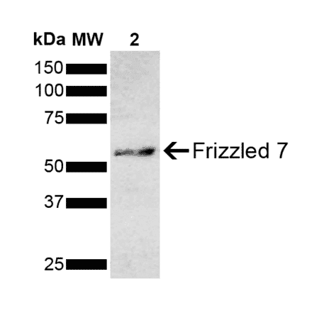 Western Blot - Anti-Frizzled 7 Antibody (A305186) - Antibodies.com