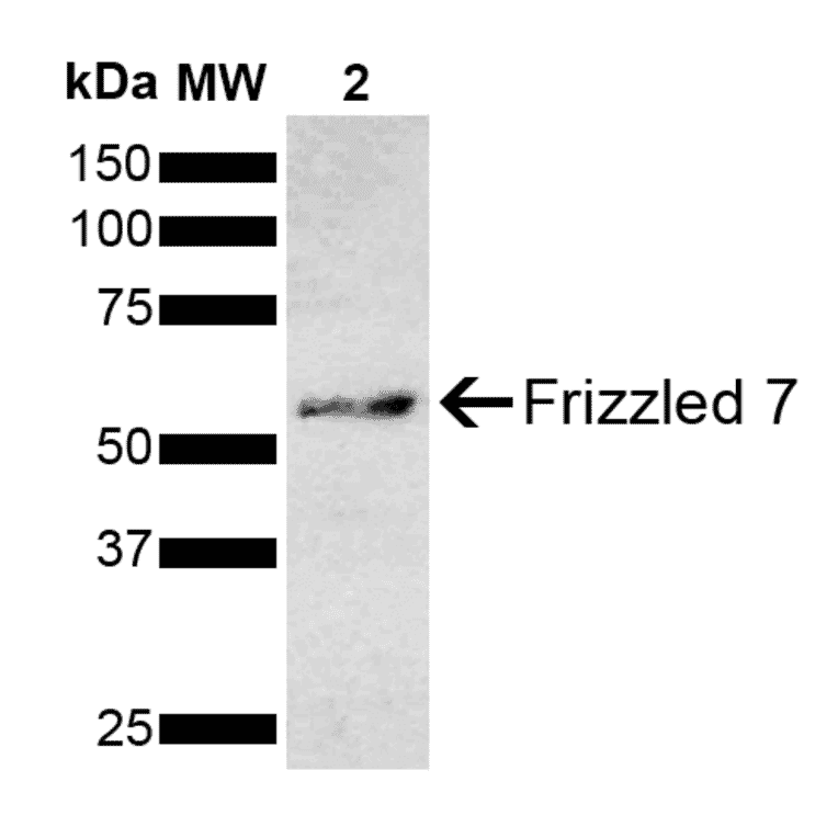 Western Blot - Anti-Frizzled 7 Antibody (A305186) - Antibodies.com