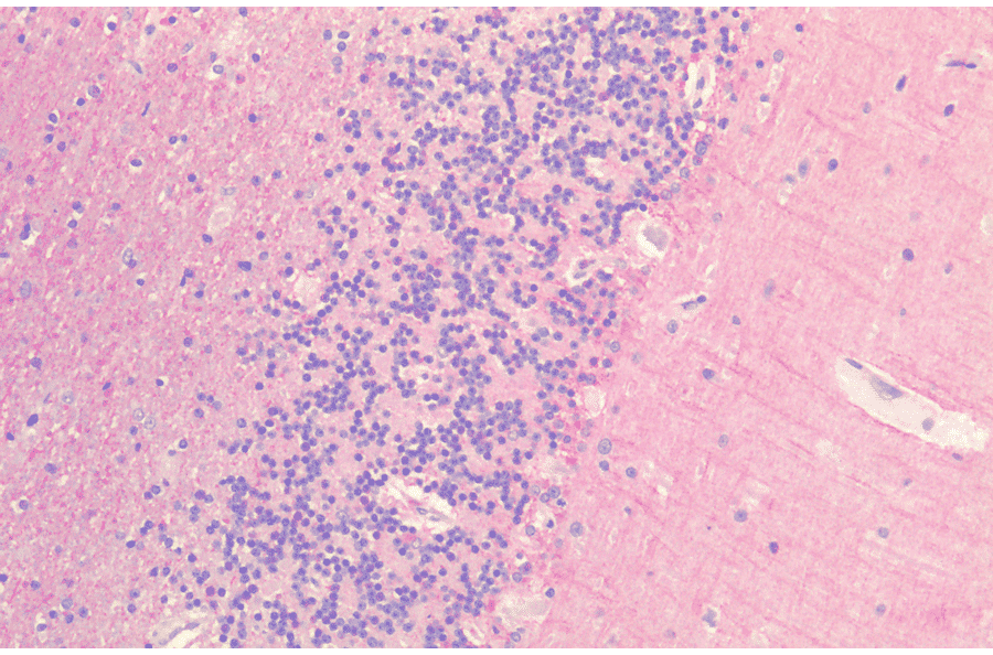Immunohistochemistry - Anti-Frizzled 7 Antibody (A305186) - Antibodies.com