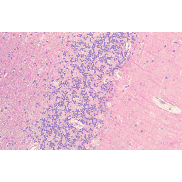 Immunohistochemistry - Anti-Frizzled 7 Antibody (A305186) - Antibodies.com