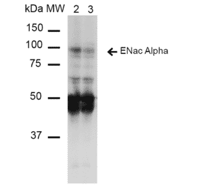 Western Blot - Anti-SCNN1A Antibody [14E10] (A305187) - Antibodies.com