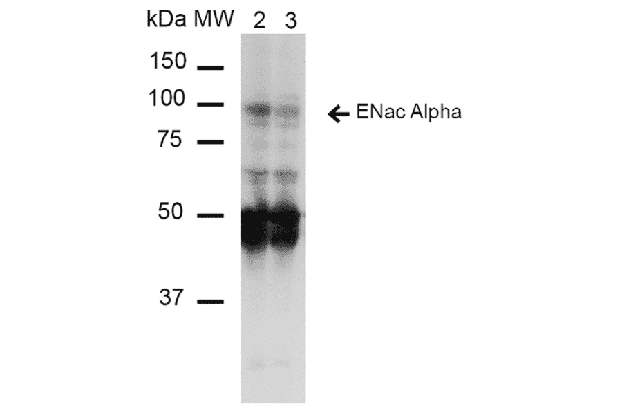 Western Blot - Anti-SCNN1A Antibody [14E10] (A305187) - Antibodies.com