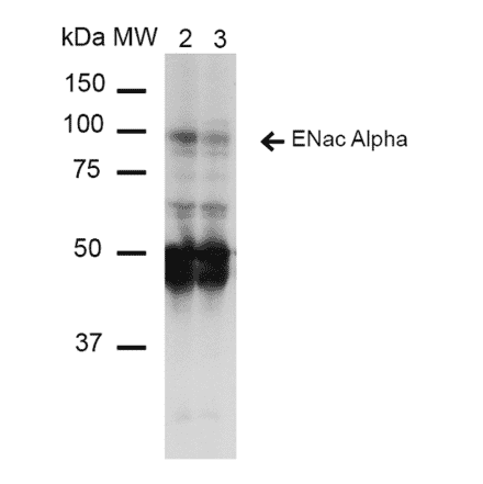 Western Blot - Anti-SCNN1A Antibody [14E10] (A305187) - Antibodies.com