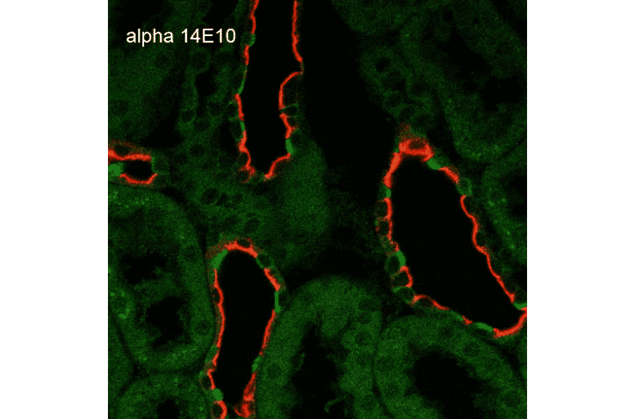 Immunohistochemistry - Anti-SCNN1A Antibody [14E10] (A305187) - Antibodies.com