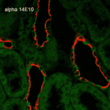 Immunohistochemistry - Anti-SCNN1A Antibody [14E10] (A305187) - Antibodies.com