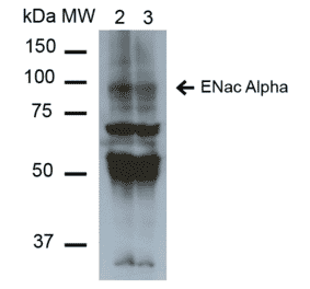 Western Blot - Anti-SCNN1A Antibody [2G4] (A305188) - Antibodies.com