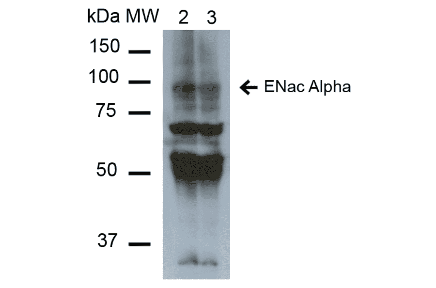 Western Blot - Anti-SCNN1A Antibody [2G4] (A305188) - Antibodies.com
