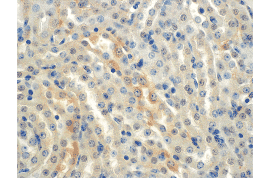 Immunohistochemistry - Anti-SCNN1A Antibody [2G4] (A305188) - Antibodies.com