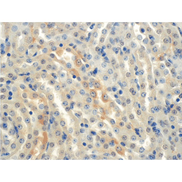 Immunohistochemistry - Anti-SCNN1A Antibody [2G4] (A305188) - Antibodies.com