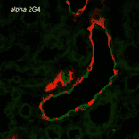 Immunohistochemistry - Anti-SCNN1A Antibody [2G4] (A305188) - Antibodies.com