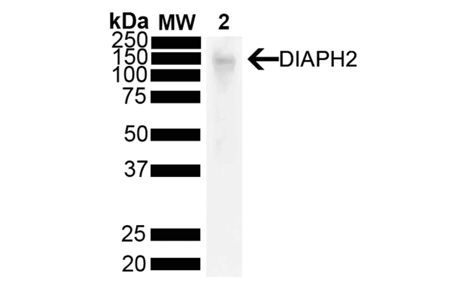 Western Blot - Anti-DIAPH2 Antibody [V78 P3C10-D3 ] (A305189) - Antibodies.com