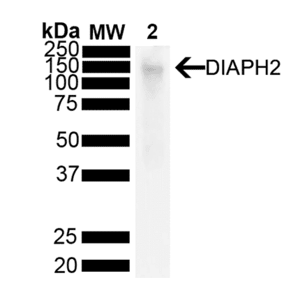 Western Blot - Anti-DIAPH2 Antibody [V78 P3C10-D3 ] (A305189) - Antibodies.com