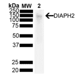 Western Blot - Anti-DIAPH2 Antibody [V78 P3C10-D3 ] (A305189) - Antibodies.com