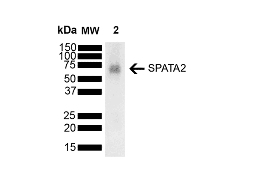 Western Blot - Anti-SPATA2 Antibody [Z1 P1F10-F12] (A305190) - Antibodies.com