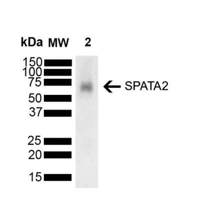 Western Blot - Anti-SPATA2 Antibody [Z1 P1F10-F12] (A305190) - Antibodies.com