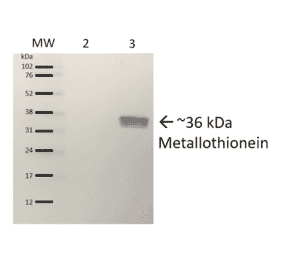 Western Blot - Anti-Metallothionein Antibody (A305192) - Antibodies.com