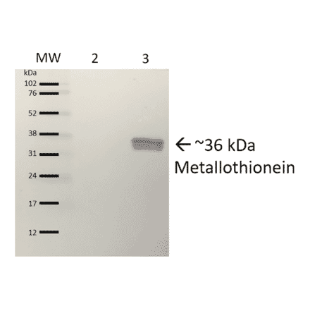 Western Blot - Anti-Metallothionein Antibody (A305192) - Antibodies.com