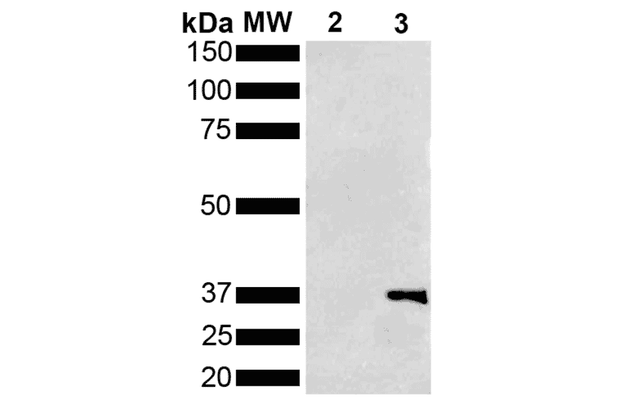 Western Blot - Anti-Metallothionein Antibody [1F5] (A305193) - Antibodies.com