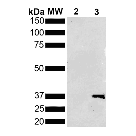 Western Blot - Anti-Metallothionein Antibody [1F5] (A305193) - Antibodies.com