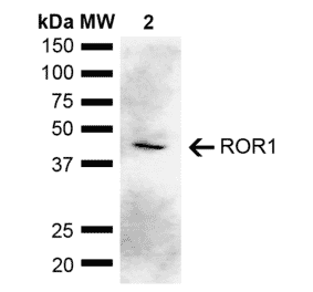 Western Blot - Anti-ROR1 Antibody (A305204) - Antibodies.com