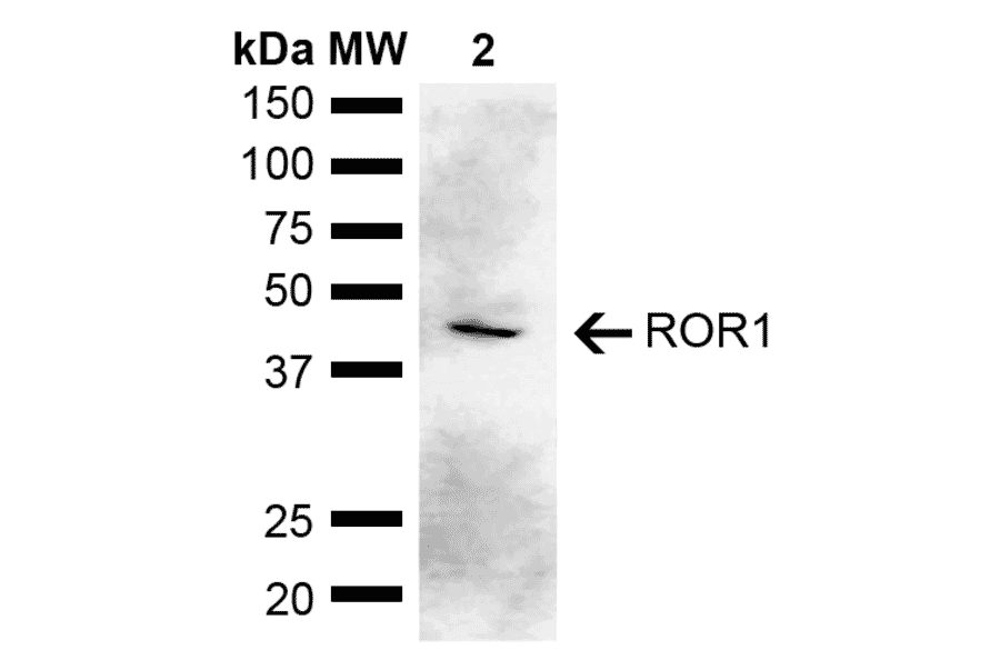 Western Blot - Anti-ROR1 Antibody (A305204) - Antibodies.com