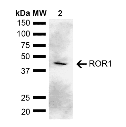 Western Blot - Anti-ROR1 Antibody (A305204) - Antibodies.com