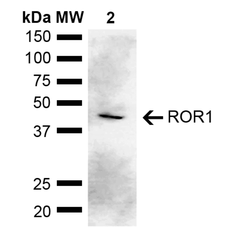 Western Blot - Anti-ROR1 Antibody (A305204) - Antibodies.com