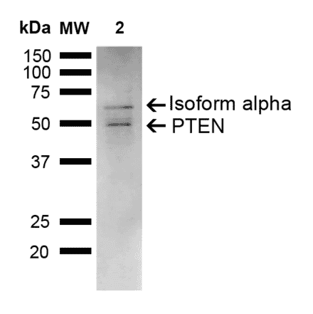 Western Blot - Anti-PTEN Antibody (A305205) - Antibodies.com