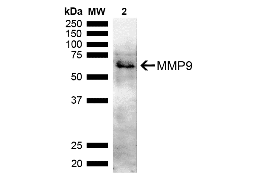 Western Blot - Anti-MMP9 Antibody (A305207) - Antibodies.com