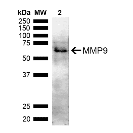 Western Blot - Anti-MMP9 Antibody (A305207) - Antibodies.com