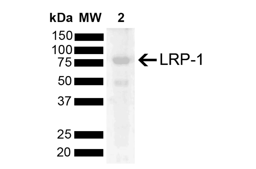 Western Blot - Anti-LRP1 Antibody (A305208) - Antibodies.com