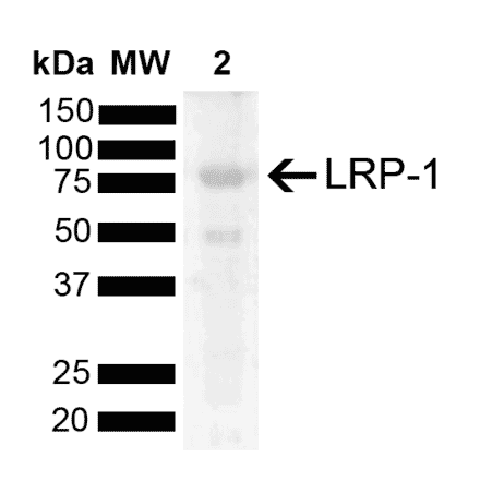 Western Blot - Anti-LRP1 Antibody (A305208) - Antibodies.com