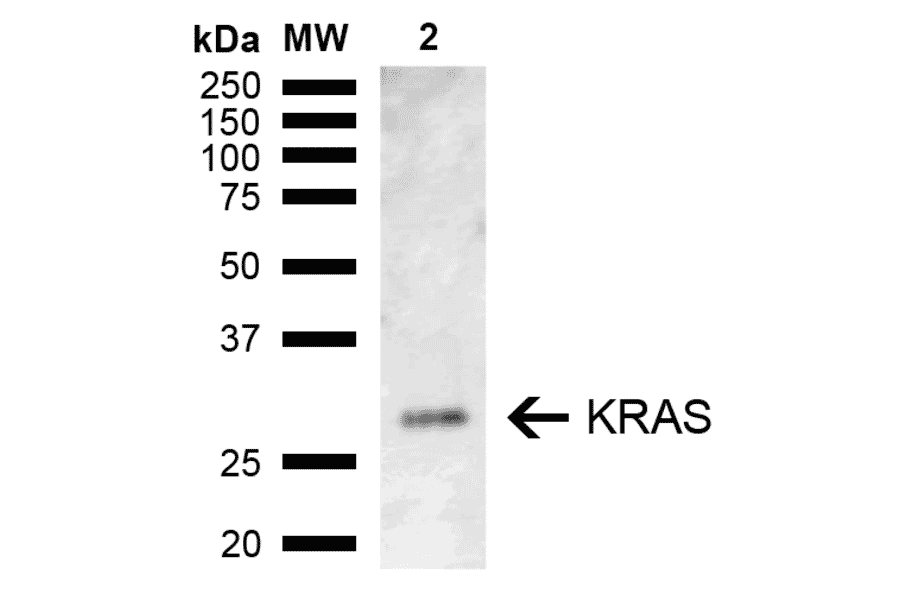 Western Blot - Anti-KRAS Antibody (A305209) - Antibodies.com