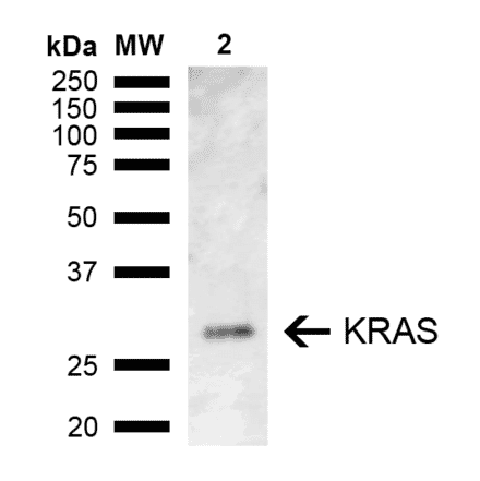 Western Blot - Anti-KRAS Antibody (A305209) - Antibodies.com