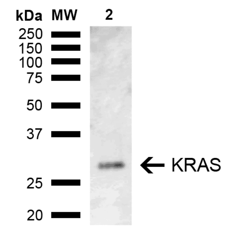 Western Blot - Anti-KRAS Antibody (A305209) - Antibodies.com