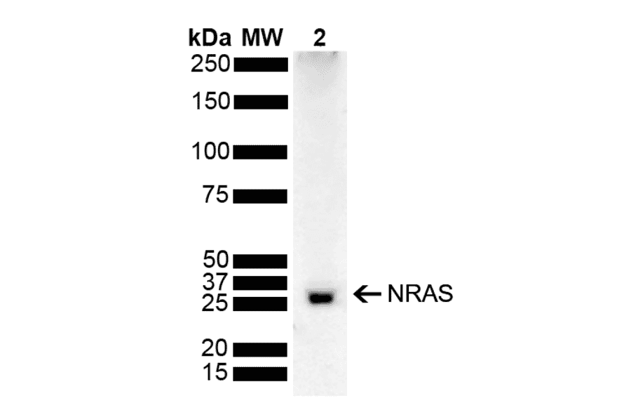 Western Blot - Anti-NRAS Antibody (A305210) - Antibodies.com