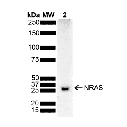 Western Blot - Anti-NRAS Antibody (A305210) - Antibodies.com