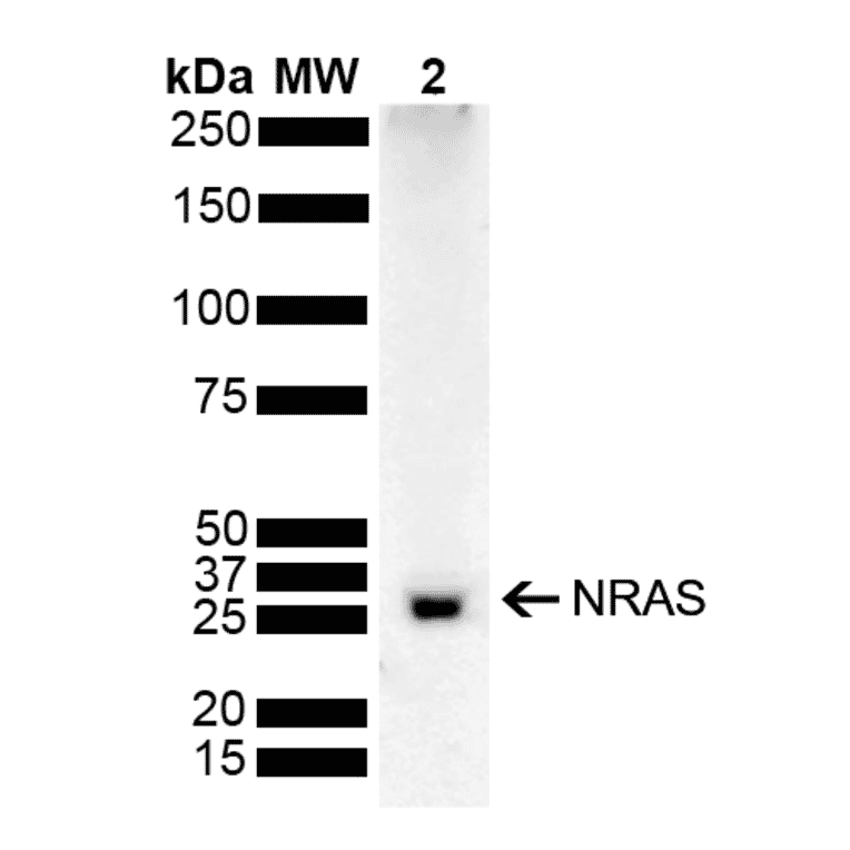 Western Blot - Anti-NRAS Antibody (A305210) - Antibodies.com