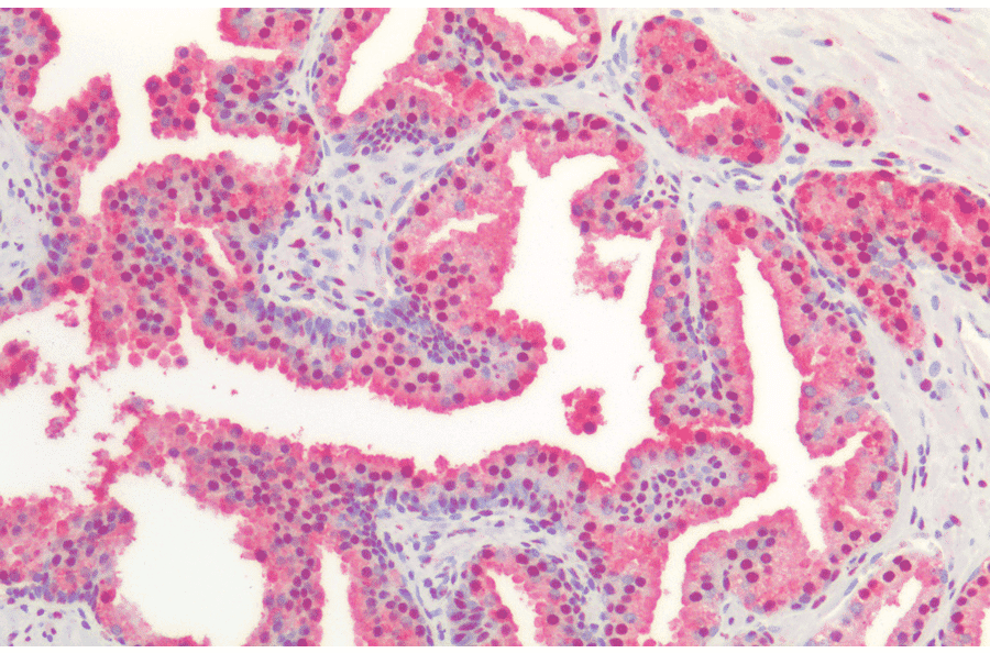 Immunohistochemistry - Anti-Bad Antibody (A305211) - Antibodies.com