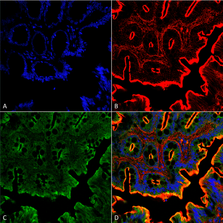Immunohistochemistry - Anti-NHE3 Antibody (A305212) - Antibodies.com