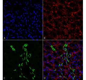 Immunohistochemistry - Anti-SLC14A2 Antibody (A305213) - Antibodies.com