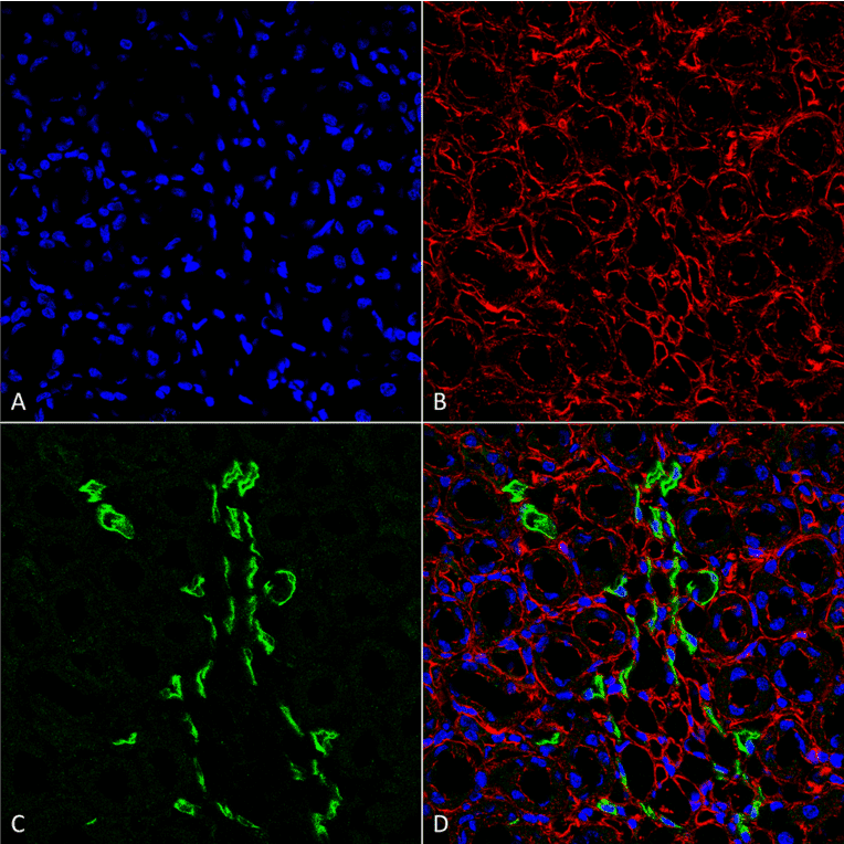 Immunohistochemistry - Anti-SLC14A2 Antibody (A305213) - Antibodies.com