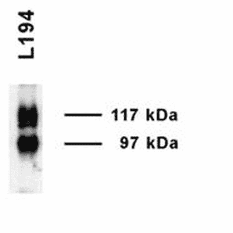 Western Blot - Anti-SLC14A2 Antibody (A305213) - Antibodies.com