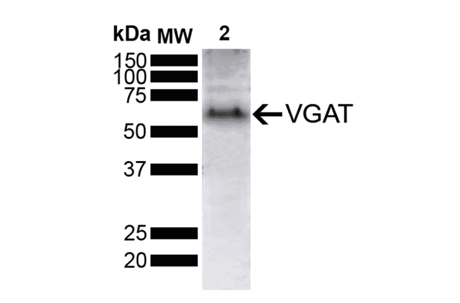 Western Blot - Anti-SLC32A1 / VGAT Antibody [D9] (A305214) - Antibodies.com