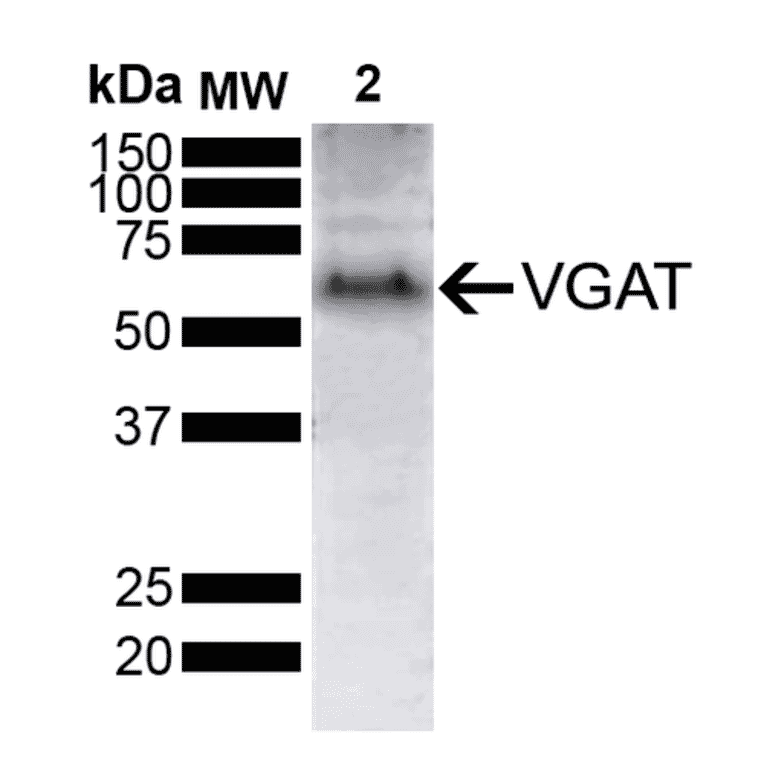 Western Blot - Anti-SLC32A1 / VGAT Antibody [D9] (A305214) - Antibodies.com