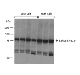 Western Blot - Anti-SCNN1G Antibody (A305215) - Antibodies.com
